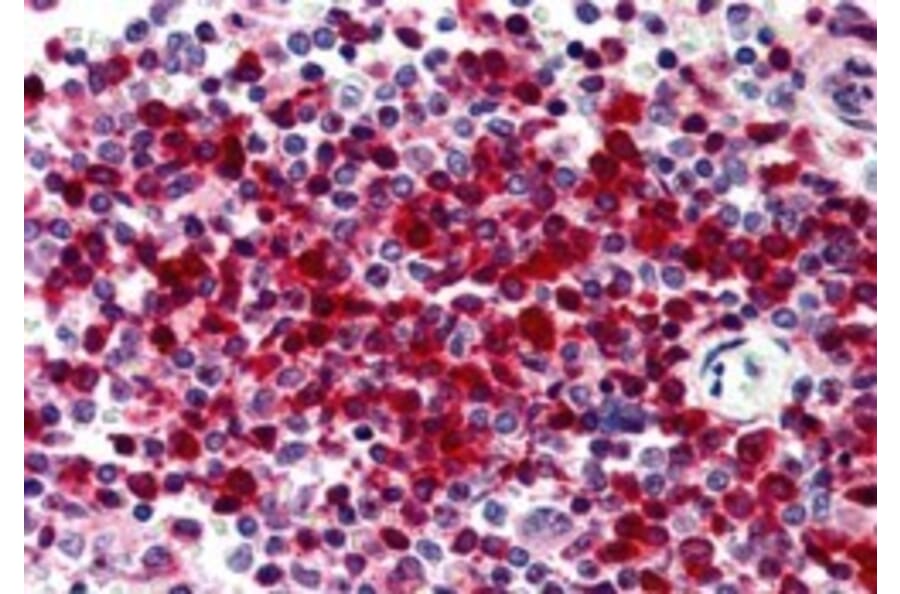 Immunohistochemistry - Anti-DKC1/Dyskerin Antibody (A84318) - Antibodies.com