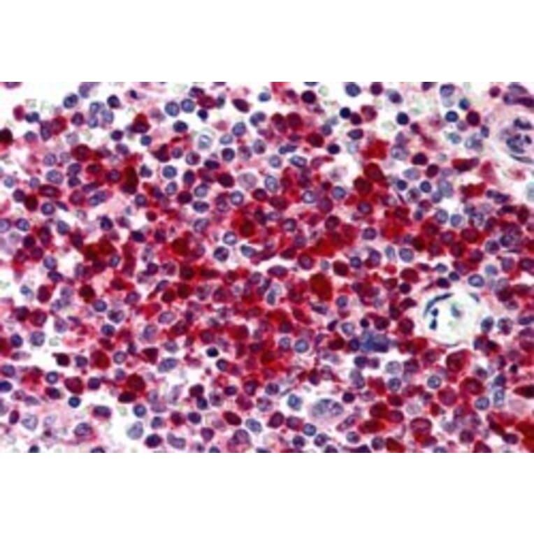 Immunohistochemistry - Anti-DKC1/Dyskerin Antibody (A84318) - Antibodies.com