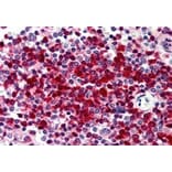 Immunohistochemistry - Anti-DKC1/Dyskerin Antibody (A84318) - Antibodies.com