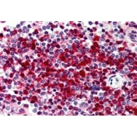 Immunohistochemistry - Anti-DKC1 Antibody (A84318) - Antibodies.com