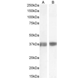 Western Blot - Anti-Liver Arginase Antibody (A84319) - Antibodies.com