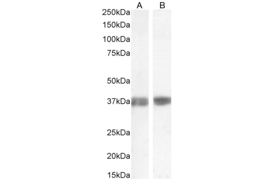 Western Blot - Anti-Liver Arginase Antibody (A84319) - Antibodies.com