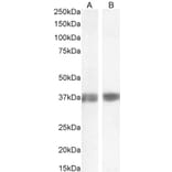 Western Blot - Anti-Liver Arginase Antibody (A84319) - Antibodies.com