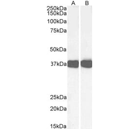 Western Blot - Anti-Arg1 Antibody (A84319) - Antibodies.com