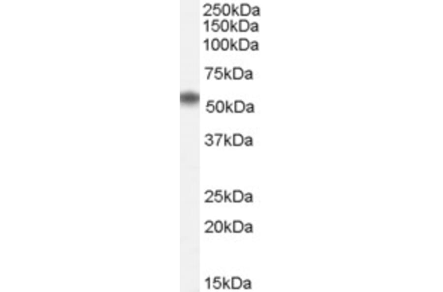 Western Blot - Anti-Nac1 Antibody (A84320) - Antibodies.com
