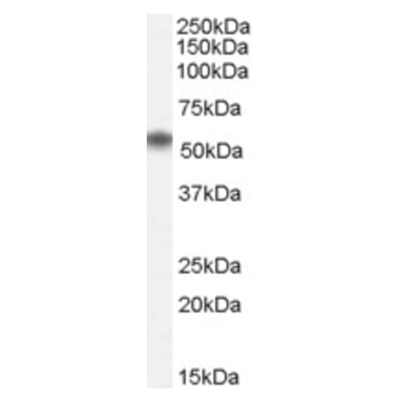 Western Blot - Anti-Nac1 Antibody (A84320) - Antibodies.com