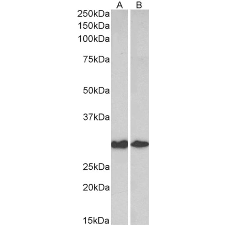 Western Blot - Anti-Galectin 3 Antibody (A84321) - Antibodies.com