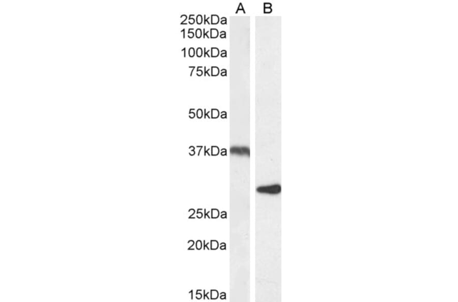 Western Blot - Anti-UCP2 Antibody (A84323) - Antibodies.com
