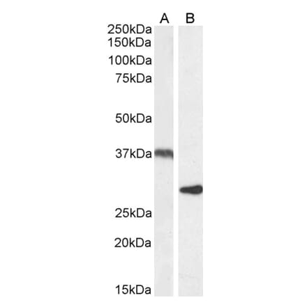 Western Blot - Anti-UCP2 Antibody (A84323) - Antibodies.com