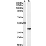 Western Blot - Anti-UCP2 Antibody (A84323) - Antibodies.com