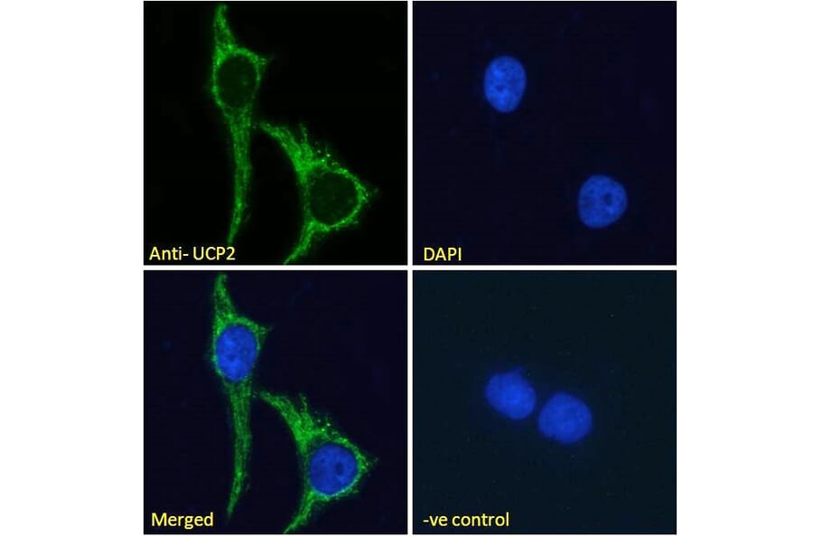 Immunofluorescence - Anti-UCP2 Antibody (A84323) - Antibodies.com
