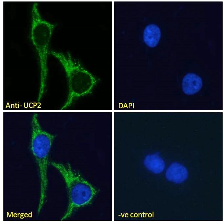 Immunofluorescence - Anti-UCP2 Antibody (A84323) - Antibodies.com