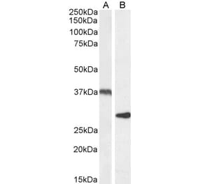 Western Blot - Anti-UCP2 Antibody (A84323) - Antibodies.com