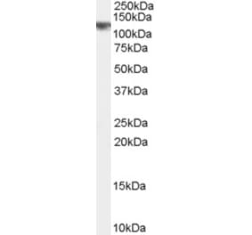 Western Blot - Anti-CYLD Antibody (A84324) - Antibodies.com