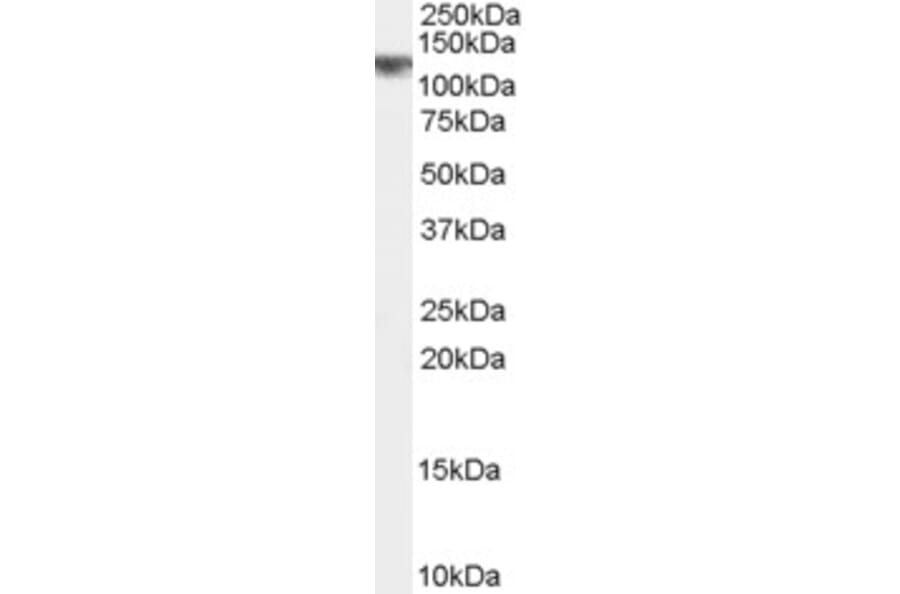 Western Blot - Anti-CYLD Antibody (A84324) - Antibodies.com