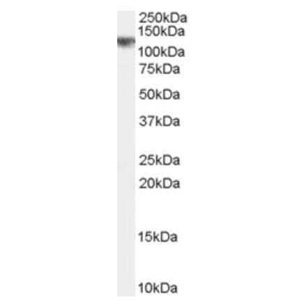 Western Blot - Anti-CYLD Antibody (A84324) - Antibodies.com