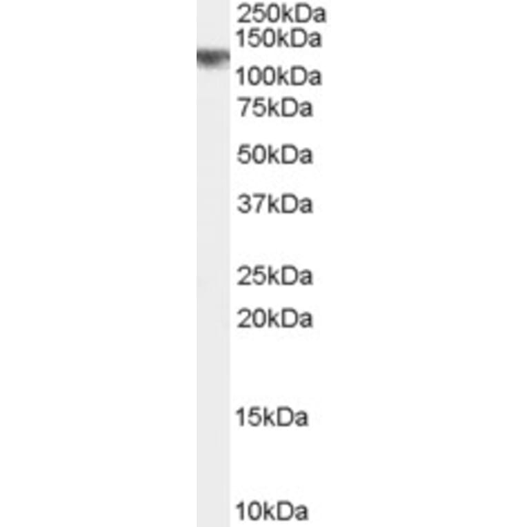 Western Blot - Anti-CYLD Antibody (A84324) - Antibodies.com