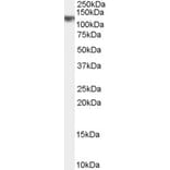 Western Blot - Anti-CYLD Antibody (A84324) - Antibodies.com