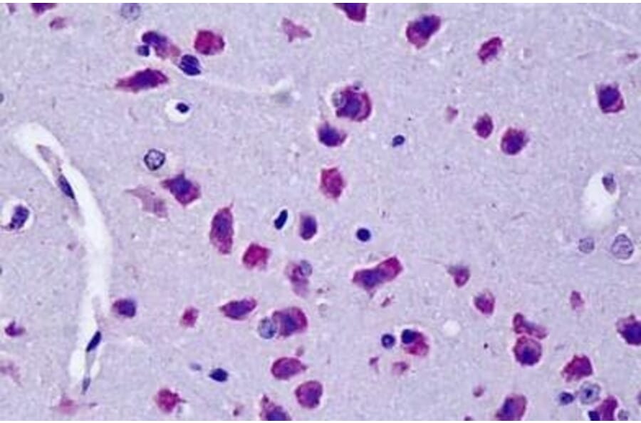 Immunohistochemistry - Anti-CYLD Antibody (A84324) - Antibodies.com