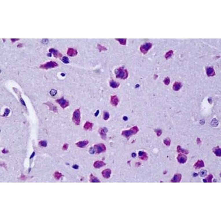 Immunohistochemistry - Anti-CYLD Antibody (A84324) - Antibodies.com