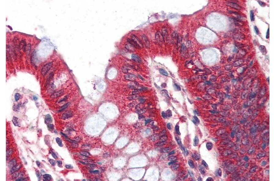Immunohistochemistry - Anti-Perilipin-1 Antibody (A84327) - Antibodies.com