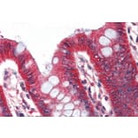 Immunohistochemistry - Anti-Perilipin-1 Antibody (A84327) - Antibodies.com