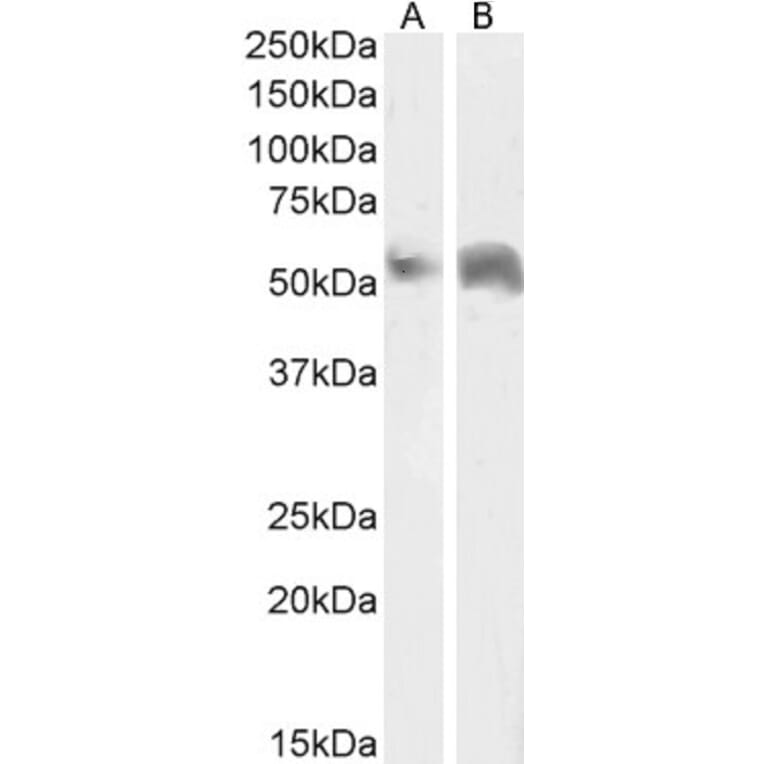 Western Blot - Anti-Perilipin-1 Antibody (A84328) - Antibodies.com