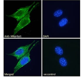 Immunofluorescence - Anti-Perilipin 3 Antibody (A84329) - Antibodies.com