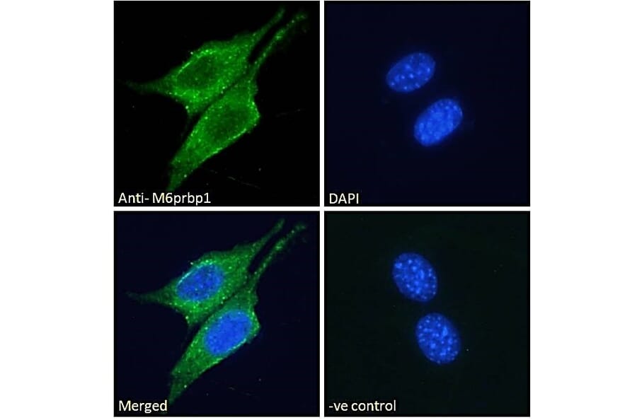 Immunofluorescence - Anti-Perilipin 3 Antibody (A84329) - Antibodies.com