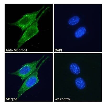 Immunofluorescence - Anti-Perilipin 3 Antibody (A84329) - Antibodies.com