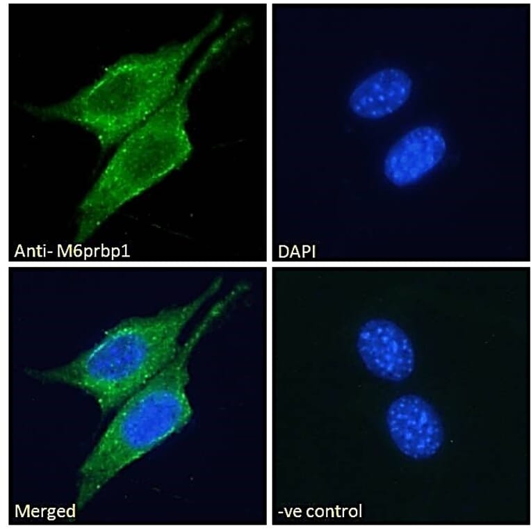 Immunofluorescence - Anti-Perilipin 3 Antibody (A84329) - Antibodies.com