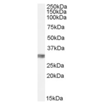 Western Blot - Anti-CLIC4 Antibody (A84333) - Antibodies.com