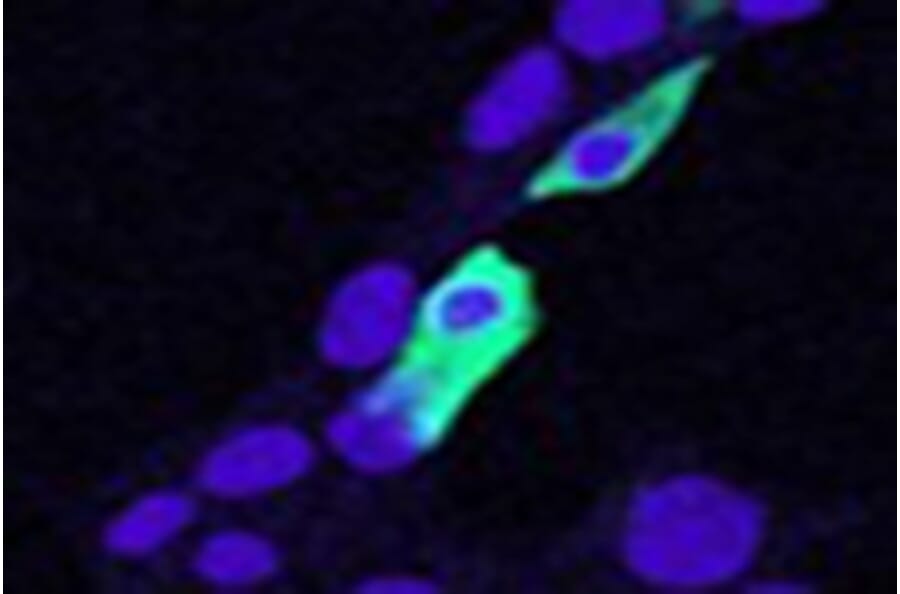 Immunofluorescence - Anti-CLIC4 Antibody (A84333) - Antibodies.com