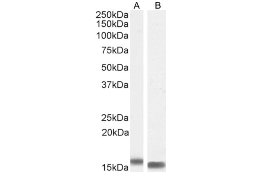 Western Blot - Anti-I-FABP Antibody (A84334) - Antibodies.com