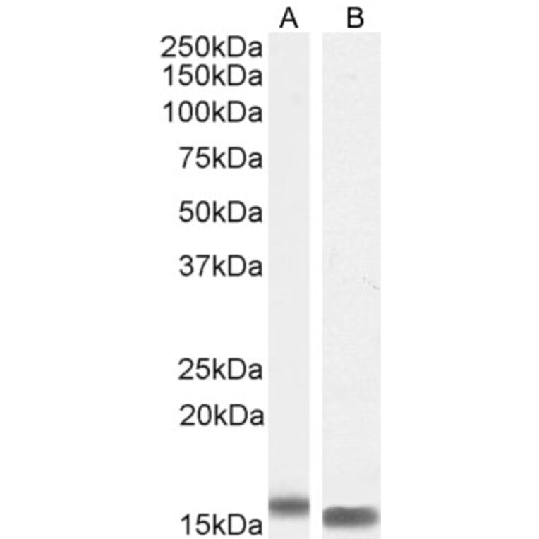Western Blot - Anti-I-FABP Antibody (A84334) - Antibodies.com