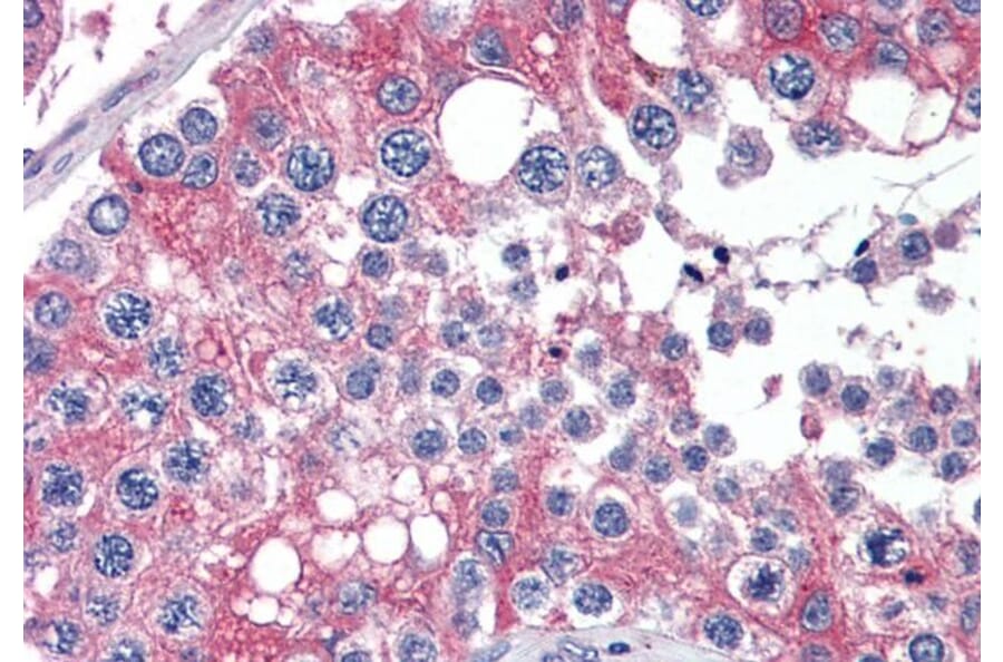Immunohistochemistry - Anti-APOBEC3G/A3G Antibody (A84336) - Antibodies.com