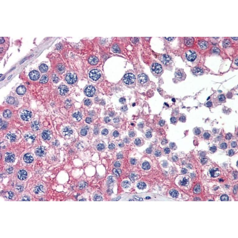 Immunohistochemistry - Anti-APOBEC3G/A3G Antibody (A84336) - Antibodies.com