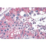 Immunohistochemistry - Anti-APOBEC3G/A3G Antibody (A84336) - Antibodies.com