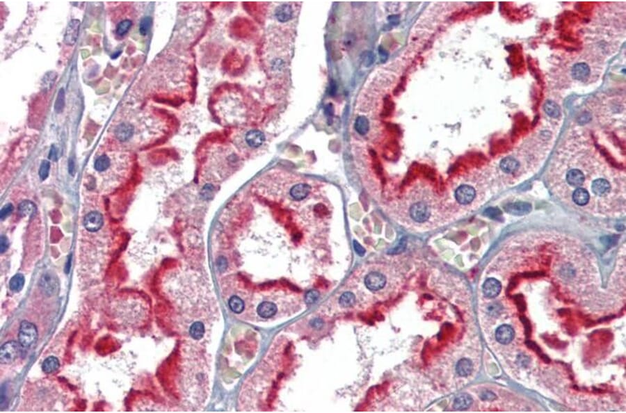 Immunohistochemistry - Anti-APOBEC3G/A3G Antibody (A84336) - Antibodies.com