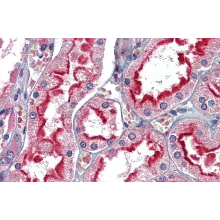 Immunohistochemistry - Anti-APOBEC3G/A3G Antibody (A84336) - Antibodies.com