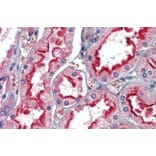 Immunohistochemistry - Anti-APOBEC3G/A3G Antibody (A84336) - Antibodies.com