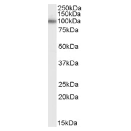 Western Blot - Anti-Mint-1 Antibody (A84338) - Antibodies.com