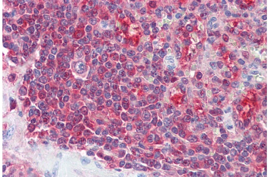 Immunohistochemistry - Anti-PSME2 Antibody (A84341) - Antibodies.com