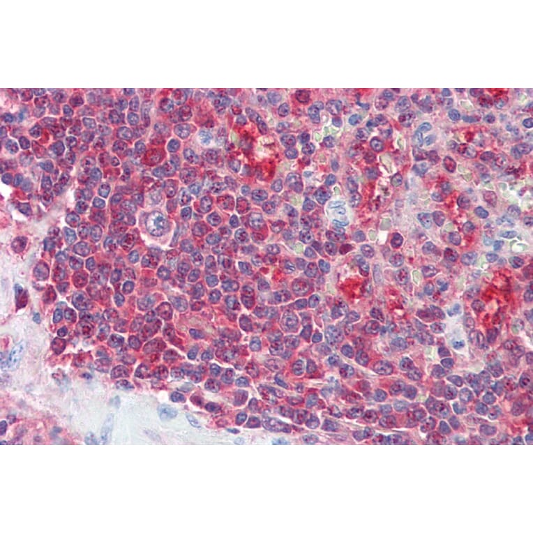 Immunohistochemistry - Anti-PSME2 Antibody (A84341) - Antibodies.com