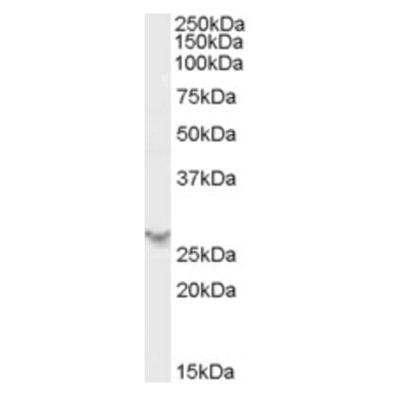 Western Blot - Anti-PSME2 Antibody (A84341) - Antibodies.com