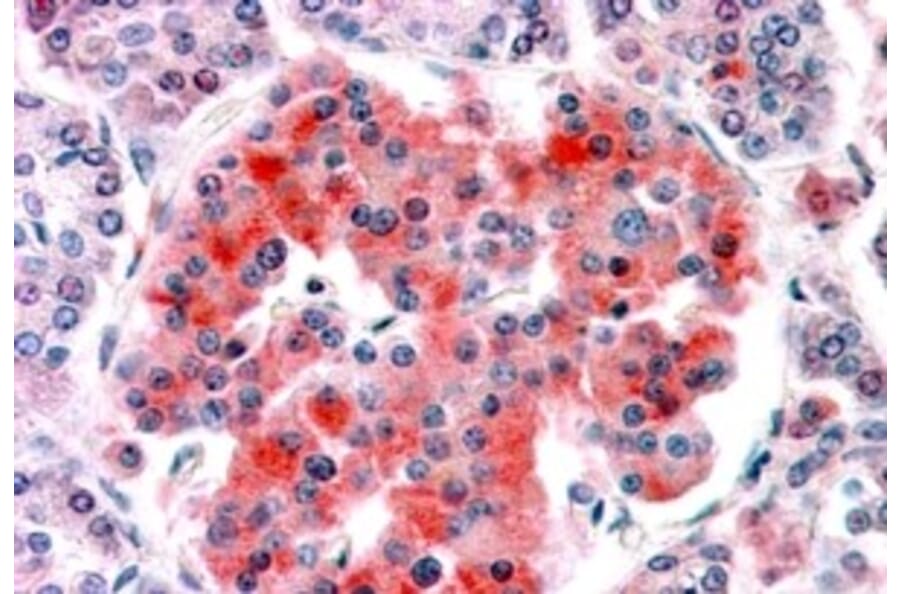 Immunohistochemistry - Anti-Kir6.2/BIR Antibody (A84342) - Antibodies.com
