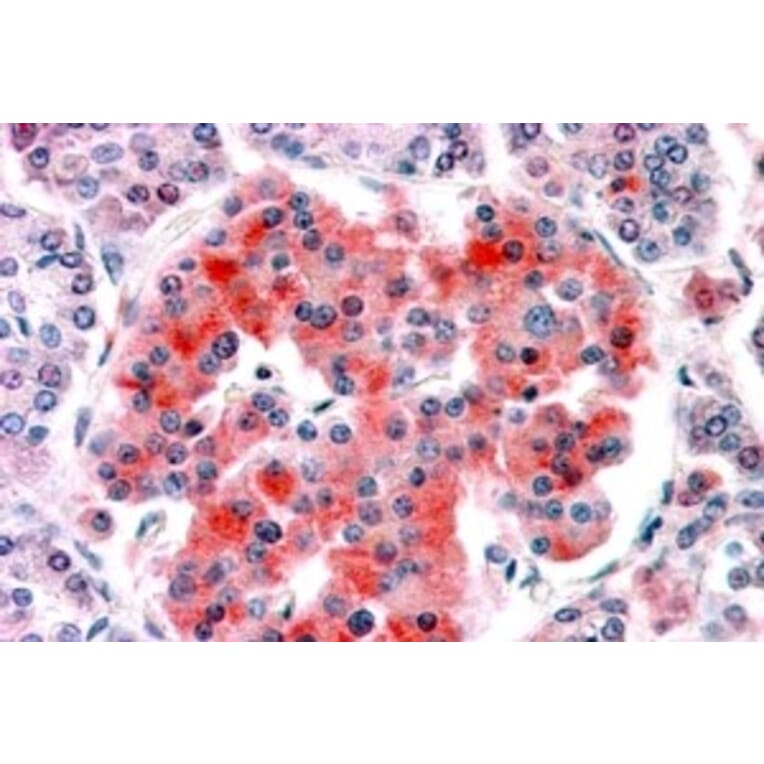 Immunohistochemistry - Anti-Kir6.2/BIR Antibody (A84342) - Antibodies.com