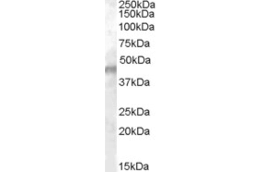 Western Blot - Anti-Kir6.2/BIR Antibody (A84342) - Antibodies.com