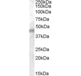 Western Blot - Anti-Kcnj11 Antibody (A84342) - Antibodies.com