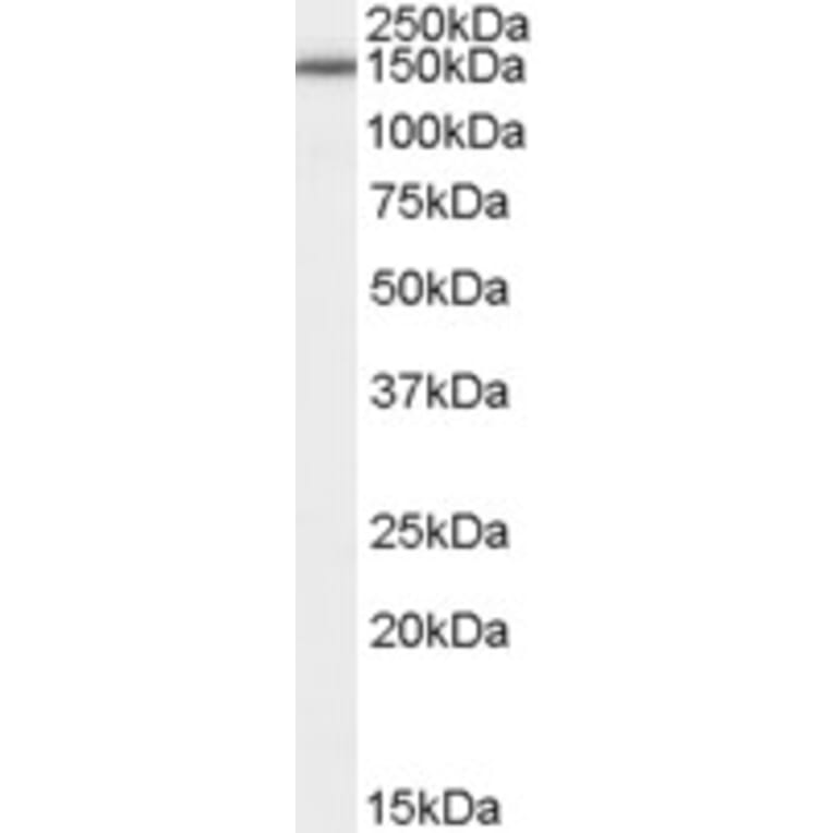 Western Blot - Anti-ROBO3 Antibody (A84343) - Antibodies.com